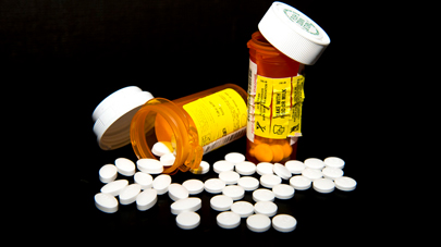 Medication allergies